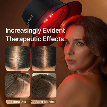 Hello Face Red Light Therapy Hair Growth Cap, 336 Chips 660nm & 850nm Near Infrared, Discreet Fisherman Hat Design Fits Up to 62cm, Professional Red Light Therapy for Full Scalp Coverage